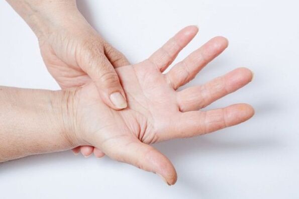 Taubheit der Hände ist eines der Symptome der lumbalen Osteochondrose. 